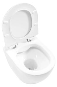 REA-C1400 - Závěsné WC s prkénkem CARTER RIMLESS keramika/bílá