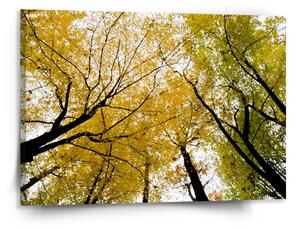 Sablio Obraz Koruny stromů - 150x110 cm