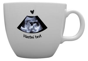 Personalizovaný MEGA XXL keramický hrnek 1 000 ml s ultrazvukem
