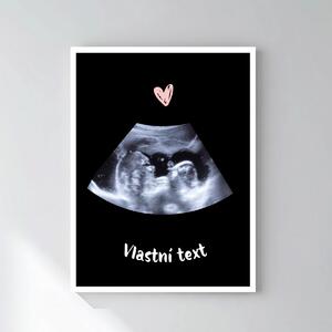 Personalizovaný magický fotoobraz v rámu - 30x40 - ultrazvuk