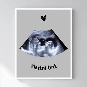 Personalizovaný magický fotoobraz v rámu - 50x70 - ultrazvuk