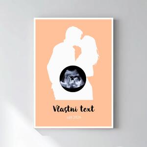 Personalizovaný magický fotoobraz v rámu - čtverec 50x70 - s párem a ultrazvukem