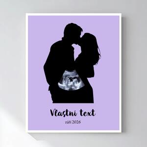 Personalizovaný magický fotoobraz v rámu - čtverec 40x50 - s párem a ultrazvukem