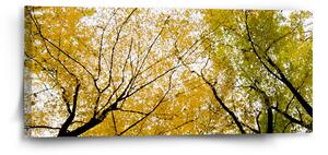 Sablio Obraz Koruny stromů - 110x50 cm