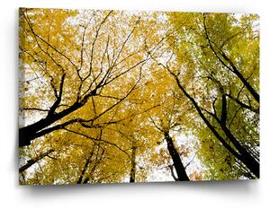 Sablio Obraz Koruny stromů - 120x80 cm