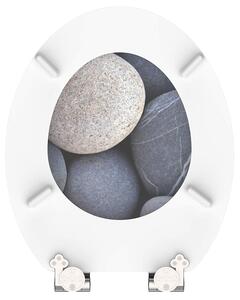 Eisl / Schuette Wc sedátko Grey stones MDF se zpomalovacím mechanismem SOFT-CLOSE