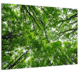 Obraz - Pohled do korun stromů (70x50 cm)