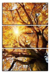 Obraz na plátně - Slunce přes větve stromu - obdélník 7240B (120x80 cm)