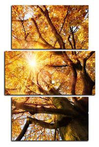 Obraz na plátně - Slunce přes větve stromu - obdélník 7240C (120x80 cm)