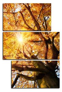 Obraz na plátně - Slunce přes větve stromu - obdélník 7240D (90x60 cm)