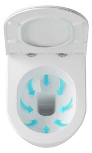 Ravak X01516 - Závěsné WC UNI CHROME keramika/bílá