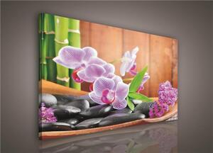 Obraz na plátně orchidej s kameny 106O1, 100 x 75 cm, IMPOL TRADE
