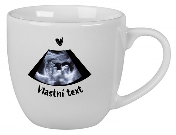Personalizovaný keramický hrníček 400 ml s ultrazvukem