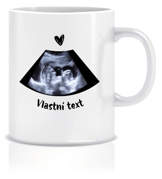 Personalizovaný klasický bílý keramický hrníček 300 ml s ultrazvukem