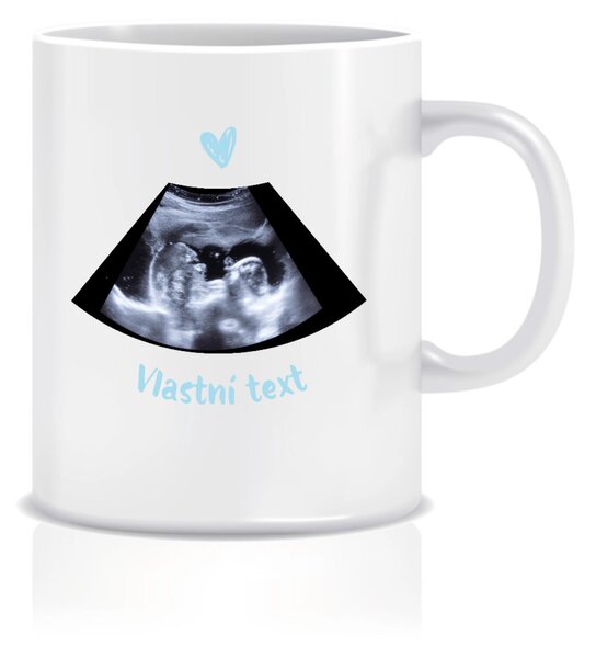 Personalizovaný klasický bílý keramický hrníček 300 ml s ultrazvukem