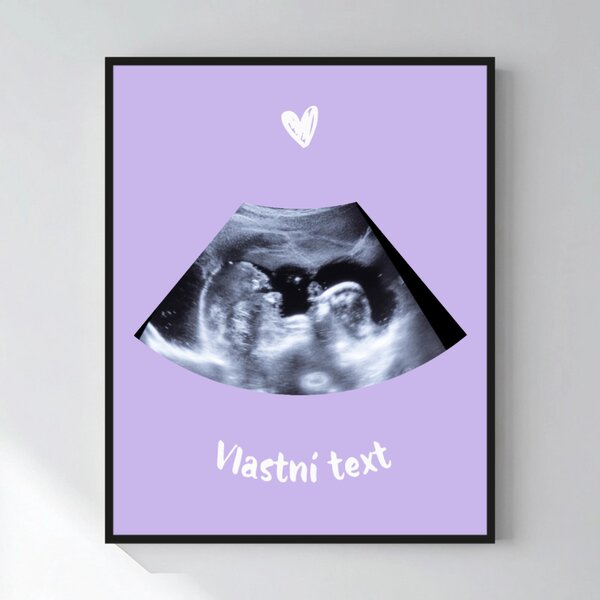 Personalizovaný magický fotoobraz v rámu - 50x70 - ultrazvuk