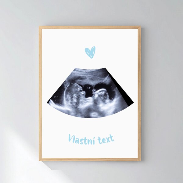Personalizovaný magický fotoobraz v rámu - 30x40 - ultrazvuk