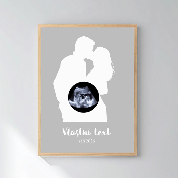 Personalizovaný magický fotoobraz v rámu - čtverec 30x40 - s párem a ultrazvukem