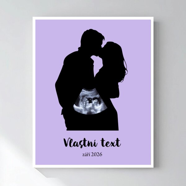 Personalizovaný magický fotoobraz v rámu - čtverec 40x50 - s párem a ultrazvukem