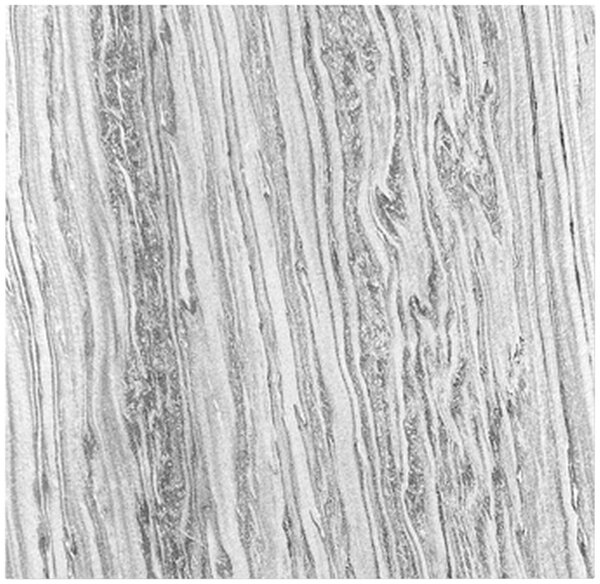 AKUSTICKÝ PANEL velikost: 52/52/0.7 cm Jangal - Online Only tapety, Online Only