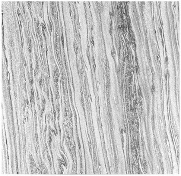 AKUSTICKÝ PANEL velikost: 52/52/0.7 cm Jangal - Online Only tapety, Online Only
