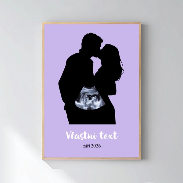 Personalizovaný magický fotoobraz v rámu - 50x70 - s párem a ultrazvukem